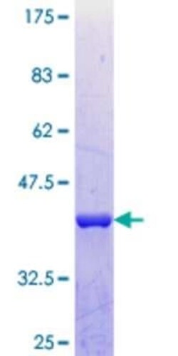 Novus Biologicals Recombinant Human TTLL1 GST (N-Term) Protein 10 &mu;g | Buy Online | Novus Biologicals&trade; | Fisher Scientific