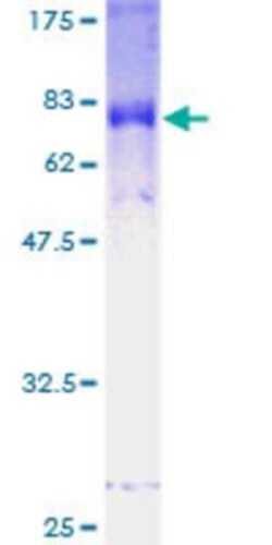 Novus Biologicals Recombinant Human FBXL2 GST (N-Term) Protein 25 &mu;g | Buy Online | Novus Biologicals&trade; | Fisher Scientific
