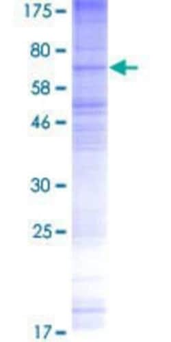 Novus Biologicals Recombinant Human TMEM184B GST (N-Term) Protein 2 &mu;g | Buy Online | Novus Biologicals&trade; | Fisher Scientific