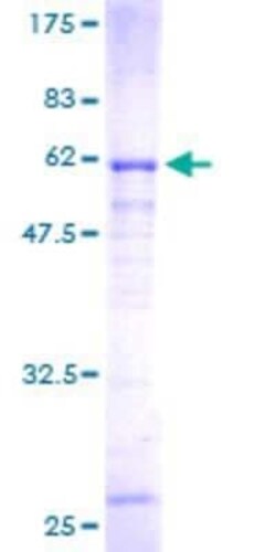 Novus Biologicals Recombinant Human Cytosolic Sulfotransferase 4A1/SULT4A1 GST (N-Term) Protein 2 &mu;g | Buy Online | Novus Biologicals&trade; | Fisher Scientific