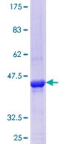 Novus Biologicals Recombinant Human Cytosolic Sulfotransferase 4A1/SULT4A1 GST (N-Term) Protein 25 &mu;g | Buy Online | Novus Biologicals&trade; | Fisher Scientific