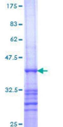 Novus Biologicals Recombinant Human RAB26 GST (N-Term) Protein 25 &mu;g | Buy Online | Novus Biologicals&trade; | Fisher Scientific