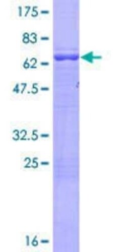 Novus Biologicals Recombinant Human ARMC8 GST (N-Term) Protein 10 &mu;g | Buy Online | Novus Biologicals&trade; | Fisher Scientific