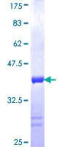 Novus Biologicals Recombinant Human DFNB31 GST (N-Term) Protein 25 &mu;g | Buy Online | Novus Biologicals&trade; | Fisher Scientific