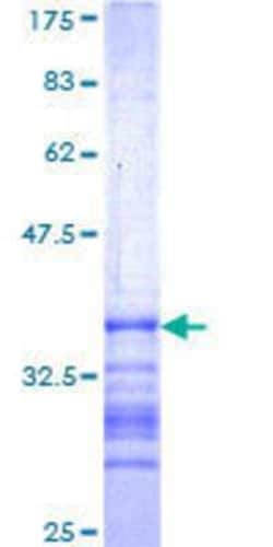 Novus Biologicals Recombinant Human USP49 GST (N-Term) Protein 25 &mu;g | Buy Online | Novus Biologicals&trade; | Fisher Scientific