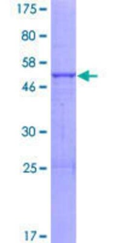 Novus Biologicals Recombinant Human ABHD14A GST (N-Term) Protein 10 &mu;g | Buy Online | Novus Biologicals&trade; | Fisher Scientific
