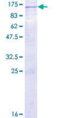 Novus Biologicals&trade;&nbsp;Recombinant Human Protein Kinase D2 GST (N-Term) Protein