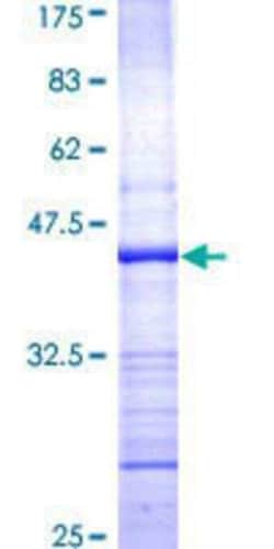 Novus Biologicals Recombinant Human Protein Kinase D2 GST (N-Term) Protein 25 &mu;g | Buy Online | Novus Biologicals&trade; | Fisher Scientific
