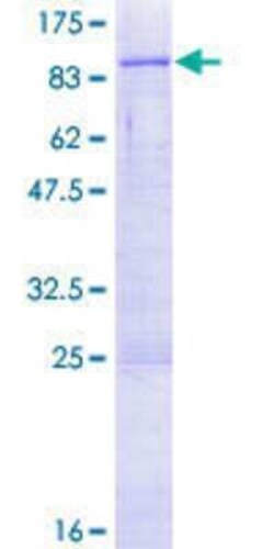 Novus Biologicals Recombinant Human NEPRO GST (N-Term) Protein 10 &mu;g | Buy Online | Novus Biologicals&trade; | Fisher Scientific