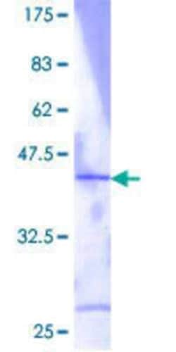 Novus Biologicals Recombinant Human RPL36 GST (N-Term) Protein 25 &mu;g | Buy Online | Novus Biologicals&trade; | Fisher Scientific