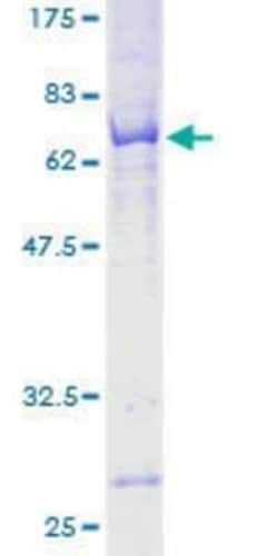 Novus Biologicals Recombinant Human WDR51A GST (N-Term) Protein 25 &mu;g | Buy Online | Novus Biologicals&trade; | Fisher Scientific