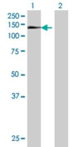 Novus Biologicals ZNF473 293T Cell Transient Overexpression Lysate 0.1 mL | Buy Online | Novus Biologicals&trade; | Fisher Scientific