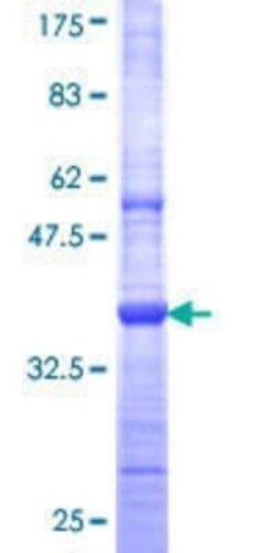 Novus Biologicals Recombinant Human TRIM58 GST (N-Term) Protein 25 &mu;g | Buy Online | Novus Biologicals&trade; | Fisher Scientific