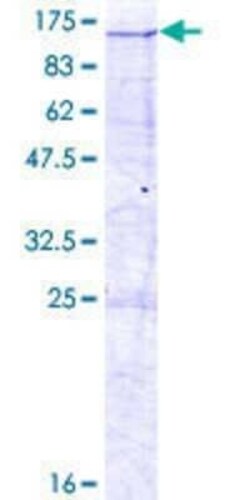 Novus Biologicals Recombinant Human DKFZP434B168 GST (N-Term) Protein 2 &mu;g | Buy Online | Novus Biologicals&trade; | Fisher Scientific