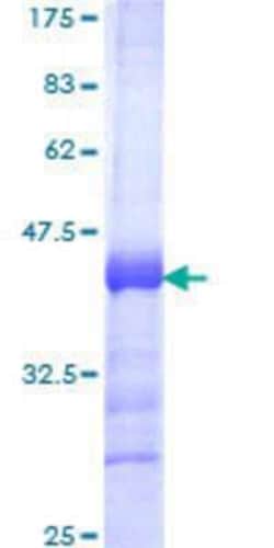Novus Biologicals Recombinant Human DORFIN GST (N-Term) Protein 25 &mu;g | Buy Online | Novus Biologicals&trade; | Fisher Scientific