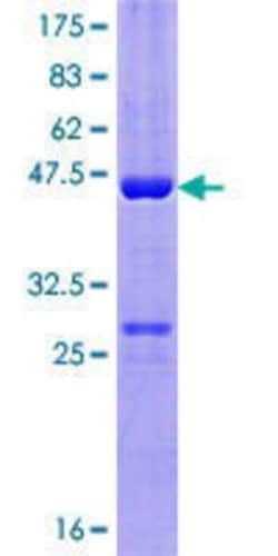 Novus Biologicals Recombinant Human CCDC28A GST (N-Term) Protein 10 &mu;g | Buy Online | Novus Biologicals&trade; | Fisher Scientific