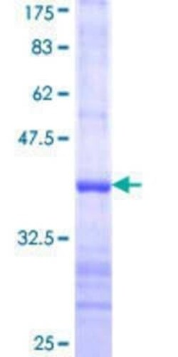 Novus Biologicals Recombinant Human MTHFD1L GST (N-Term) Protein 10 &mu;g | Buy Online | Novus Biologicals&trade; | Fisher Scientific