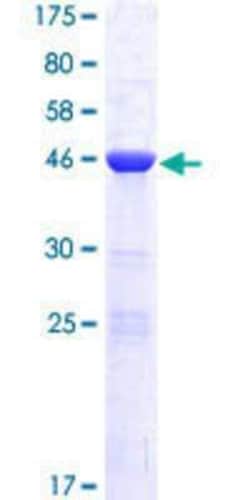 Novus Biologicals Recombinant Human DKFZp566F084 GST (N-Term) Protein 25 &mu;g | Buy Online | Novus Biologicals&trade; | Fisher Scientific