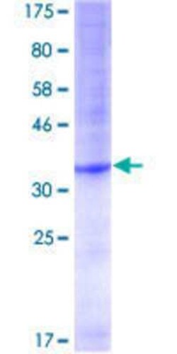 Novus Biologicals Recombinant Human POT1 GST (N-Term) Protein 10 &mu;g | Buy Online | Novus Biologicals&trade; | Fisher Scientific