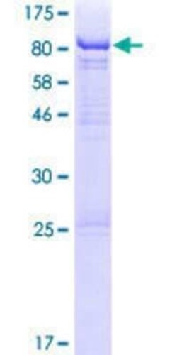 Novus Biologicals Recombinant Human THUMPD3 GST (N-Term) Protein 10 &mu;g | Buy Online | Novus Biologicals&trade; | Fisher Scientific