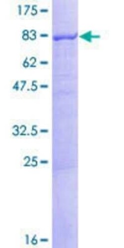 Novus Biologicals Recombinant Human Atlastin-3 GST (N-Term) Protein 25 &mu;g | Buy Online | Novus Biologicals&trade; | Fisher Scientific