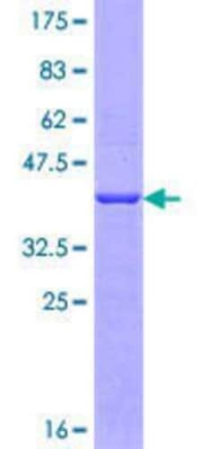 Novus Biologicals Recombinant Human Gemin 5 GST (N-Term) Protein 10 &mu;g | Buy Online | Novus Biologicals&trade; | Fisher Scientific