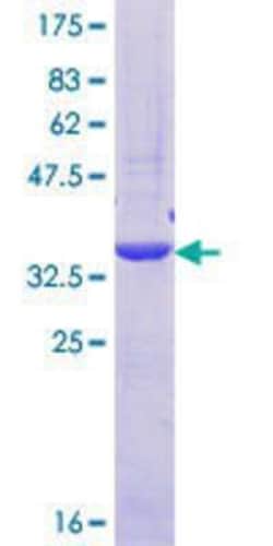 Novus Biologicals Recombinant Human PTPN23 GST (N-Term) Protein 10 &mu;g | Buy Online | Novus Biologicals&trade; | Fisher Scientific