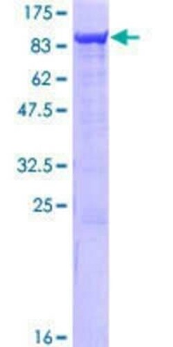 Novus Biologicals Recombinant Human SAMHD1 GST (N-Term) Protein 25 &mu;g | Buy Online | Novus Biologicals&trade; | Fisher Scientific