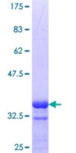 Novus Biologicals Recombinant Human SIN3A GST (N-Term) Protein 10 &mu;g | Buy Online | Novus Biologicals&trade; | Fisher Scientific