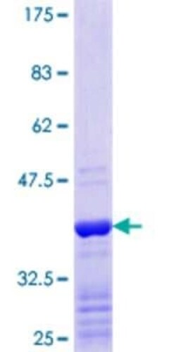 Novus Biologicals Recombinant Human ZNF385 GST (N-Term) Protein 25 &mu;g | Buy Online | Novus Biologicals&trade; | Fisher Scientific
