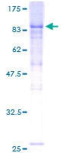 Novus Biologicals&trade;&nbsp;Recombinant Human KBTBD2 GST (N-Term) Protein