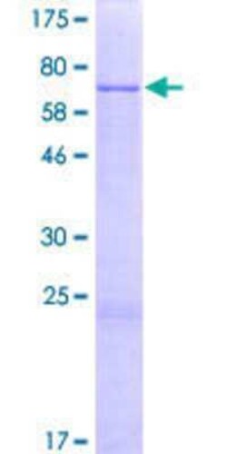 Novus Biologicals Recombinant Human PNKD GST (N-Term) Protein 2 &mu;g | Buy Online | Novus Biologicals&trade; | Fisher Scientific