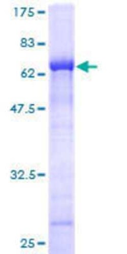 Novus Biologicals Recombinant Human C2CD2 GST (N-Term) Protein 25 &mu;g | Buy Online | Novus Biologicals&trade; | Fisher Scientific