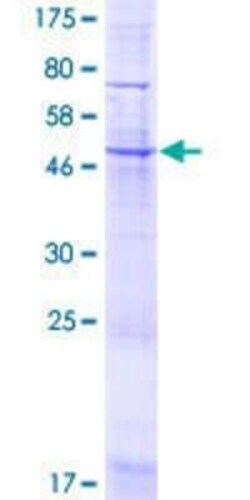 Novus Biologicals Recombinant Human UNC50 GST (N-Term) Protein 2 &mu;g | Buy Online | Novus Biologicals&trade; | Fisher Scientific