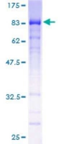 Novus Biologicals Recombinant Human HINFP GST (N-Term) Protein 2 &mu;g | Buy Online | Novus Biologicals&trade; | Fisher Scientific