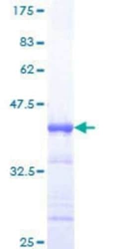 Novus Biologicals Recombinant Human HINFP GST (N-Term) Protein 10 &mu;g | Buy Online | Novus Biologicals&trade; | Fisher Scientific