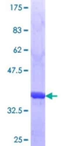 Novus Biologicals Recombinant Human ULK3 GST (N-Term) Protein 10 &mu;g | Buy Online | Novus Biologicals&trade; | Fisher Scientific