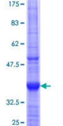 Novus Biologicals Recombinant Human CLIP3 GST (N-Term) Protein 10 &mu;g | Buy Online | Novus Biologicals&trade; | Fisher Scientific