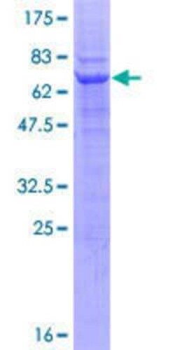 Novus Biologicals Recombinant Human RNF167 GST (N-Term) Protein 25 &mu;g | Buy Online | Novus Biologicals&trade; | Fisher Scientific