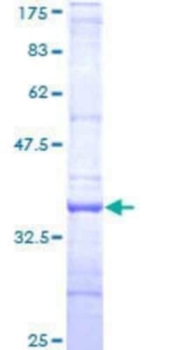 Novus Biologicals Recombinant Human RNF167 GST (N-Term) Protein 25 &mu;g | Buy Online | Novus Biologicals&trade; | Fisher Scientific