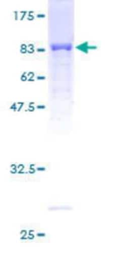 Novus Biologicals Recombinant Human DAK GST (N-Term) Protein 25 &mu;g | Buy Online | Novus Biologicals&trade; | Fisher Scientific