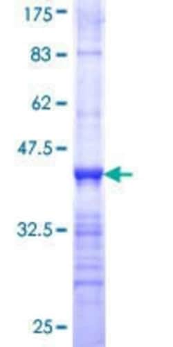 Novus Biologicals Recombinant Human DAK GST (N-Term) Protein 10 &mu;g | Buy Online | Novus Biologicals&trade; | Fisher Scientific