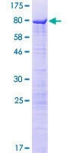 Novus Biologicals Recombinant Human SPATS2L GST (N-Term) Protein 10 &mu;g | Buy Online | Novus Biologicals&trade; | Fisher Scientific