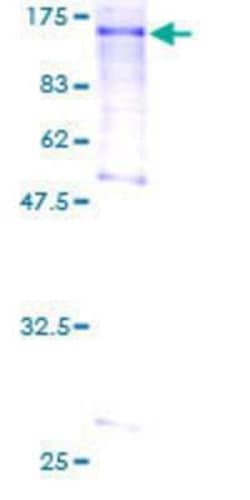 Novus Biologicals Recombinant Human L3MBTL1 GST (N-Term) Protein 25 &mu;g | Buy Online | Novus Biologicals&trade; | Fisher Scientific