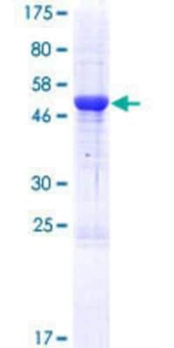 Novus Biologicals Recombinant Human TMEM98 GST (N-Term) Protein 25 &mu;g | Buy Online | Novus Biologicals&trade; | Fisher Scientific