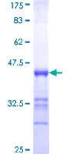 Novus Biologicals Recombinant Human PCDHGA12 GST (N-Term) Protein 10 &mu;g | Buy Online | Novus Biologicals&trade; | Fisher Scientific