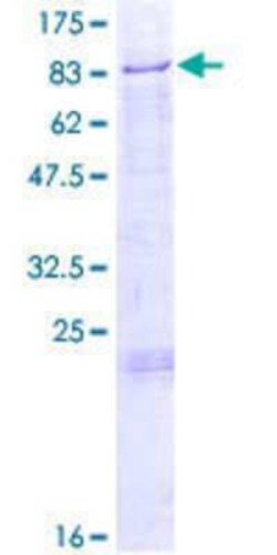 Novus Biologicals Recombinant Human Glucuronic Acid Epimerase GST (N-Term) Protein 2 &mu;g | Buy Online | Novus Biologicals&trade; | Fisher Scientific