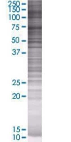 Novus Biologicals Glucuronic Acid Epimerase 293T Cell Transient Overexpression Lysate 0.1 mL | Buy Online | Novus Biologicals&trade; | Fisher Scientific