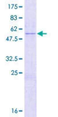 Novus Biologicals Recombinant Human SETBP1 GST (N-Term) Protein 2 &mu;g | Buy Online | Novus Biologicals&trade; | Fisher Scientific
