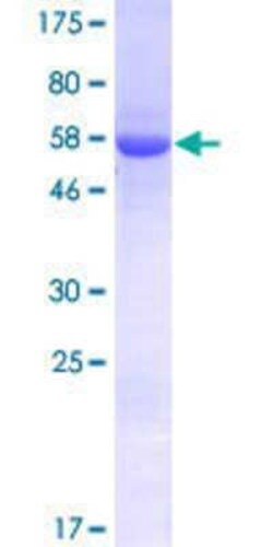 Novus Biologicals Recombinant Human UBXN7 GST (N-Term) Protein 25 &mu;g | Buy Online | Novus Biologicals&trade; | Fisher Scientific